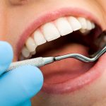 periodontitis y COVID-19