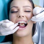 limpieza dental profesional