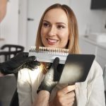 Tipos de carillas dentales y cómo elegir la adecuada